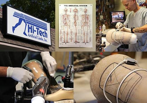 Hi-Tech Artificial Limbs