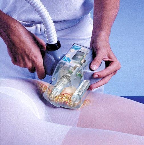 LPG Endermologie Cellulite & Lymphatic Treatments