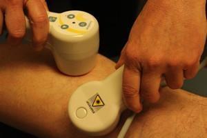 Cold Laser Treatment