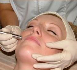 MicroExfoliation Facial