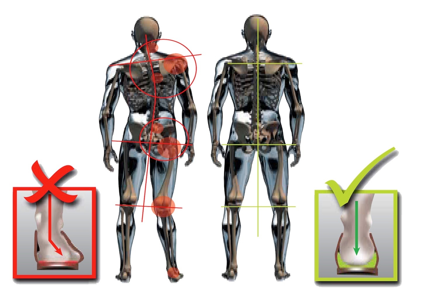 Are you out of alignment?