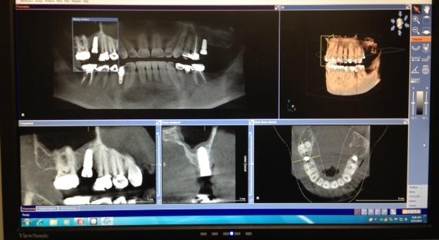 3D Scanning Cone Beam technology