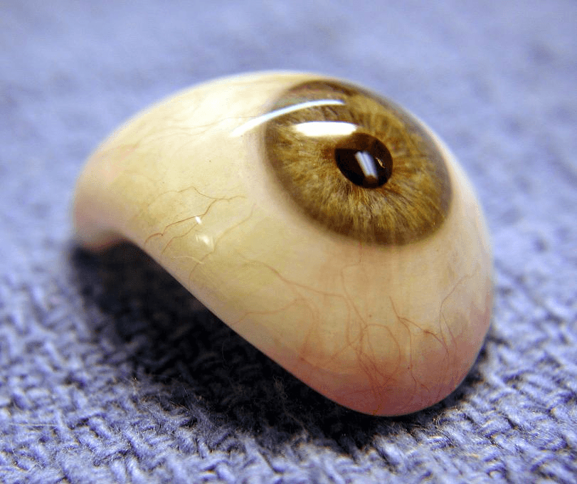 Artificial Eye / Prosthetic Eye / Ocular Prosthetic www.ocularpro.com