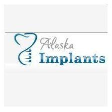 dental implants alaska