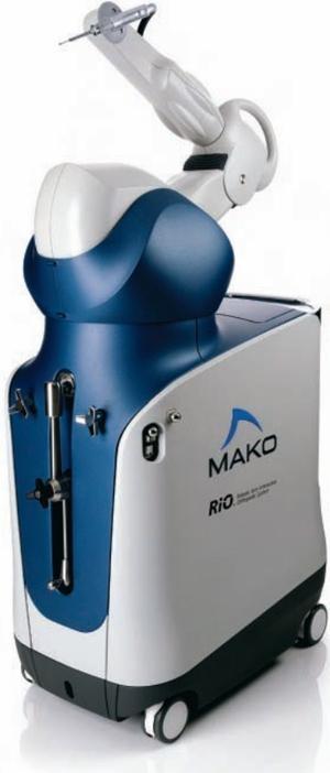 Makoplasty Robot Assisted Joint Replacement