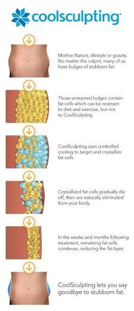 How CoolSculpting Works