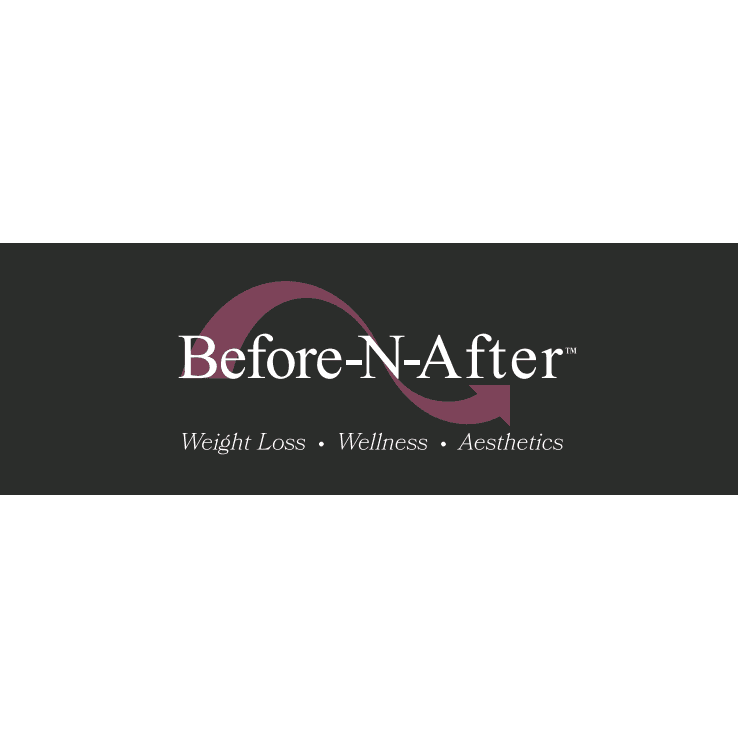 Before-N-After