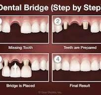 Smile Shine Family Dental