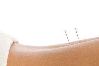 Total Wellness Acupuncture