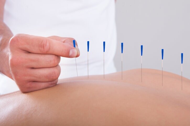 Anna Tsang Acupuncture