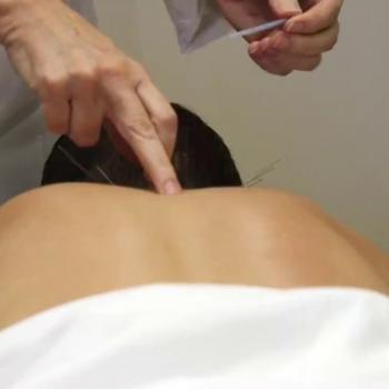 Acupuncturist NYC