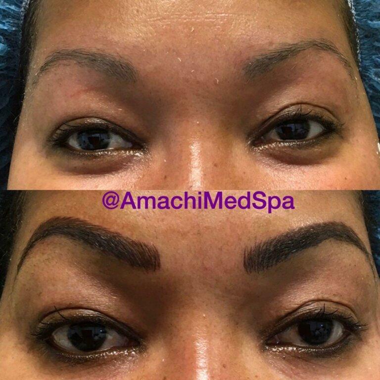 AmaChi MedSpa