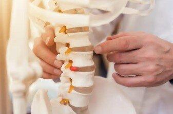 Dr.Michael D. Schurdell: The Physicians Spine & Rehabilitation Specialists