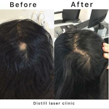 Distill Laser Clinic Oakville