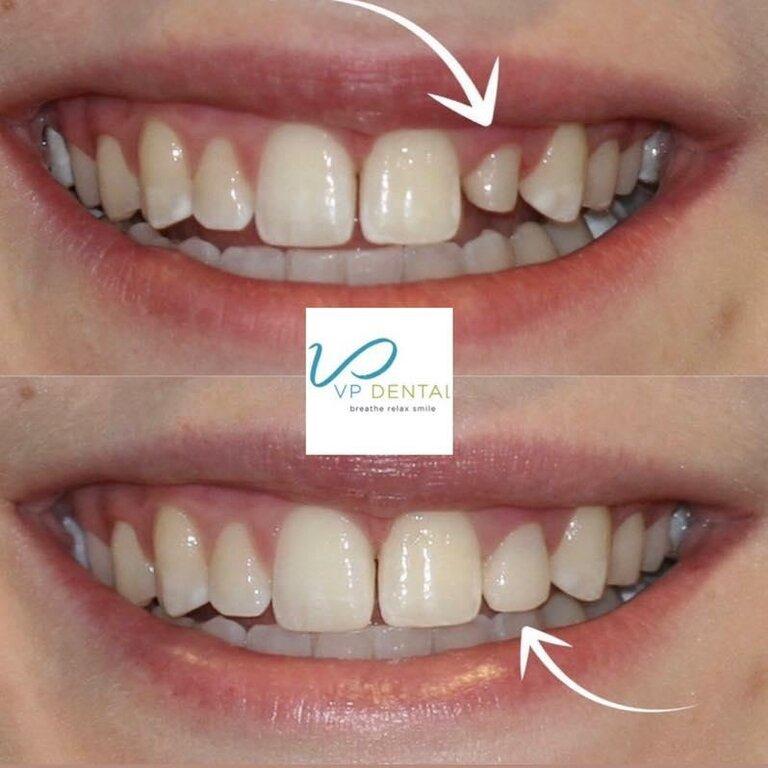 VP Dental: Cosmetic & Family Dentist