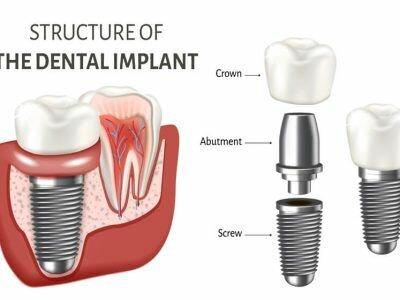 Mt. Pleasant Modern Dentistry