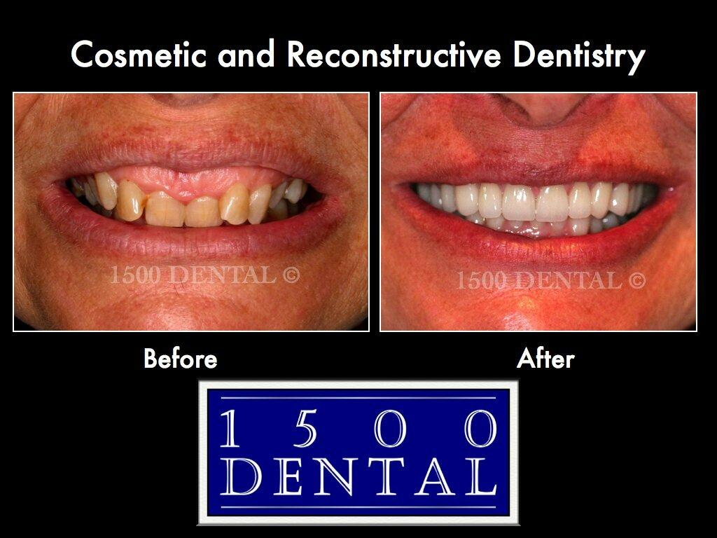 1500 Dental