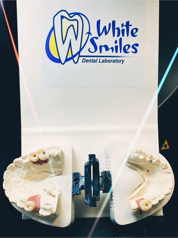 White Smiles Dental Lab