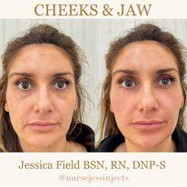 Nurse Jess Injects Injectables & Aesthetics Lounge