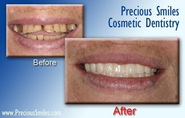 Miami Beach Cosmetic dentist Dr. Mereos