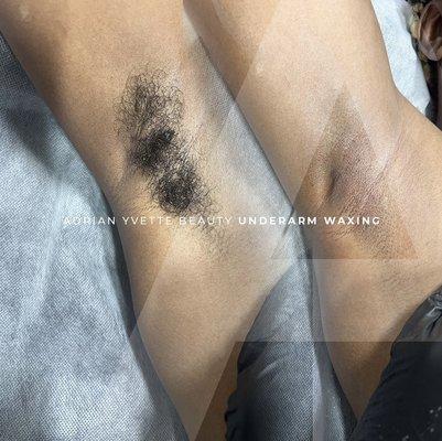 Before & After Underarm Wax Service