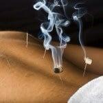 Heat Therapy at Endless Possibilities Acupuncture, Inc.