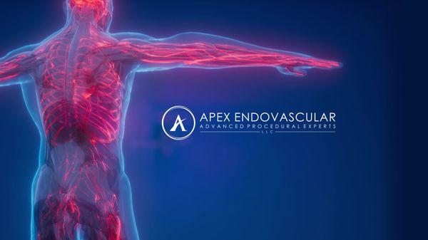 Apex Endovascular: Advanced Procedural Experts