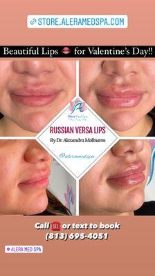 Russian Versa lips