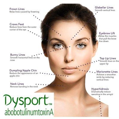 Dysport brand botox