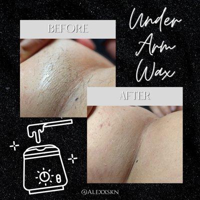 Underarm wax