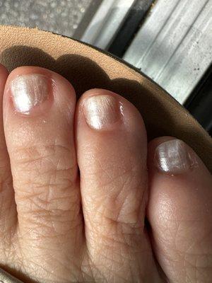 Nails not completely covered with polish.