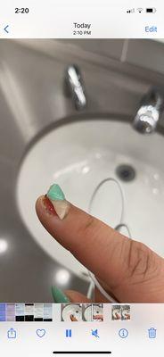 Nail ripped off from acrylic