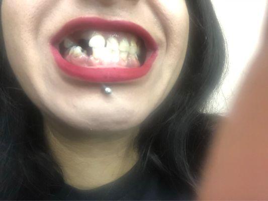 What I started with. This one without my partial dentures