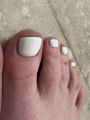 Bad pedicure