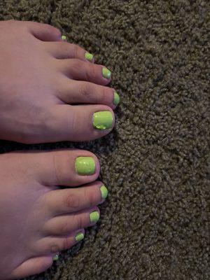 Wonky pedicure.