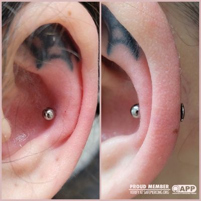 #conchpiercing #conch #piercing #bodyjewelry #piercings #cartlidgepiercings #earpiercings #snugpiercing #orbital