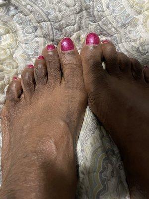 My feet