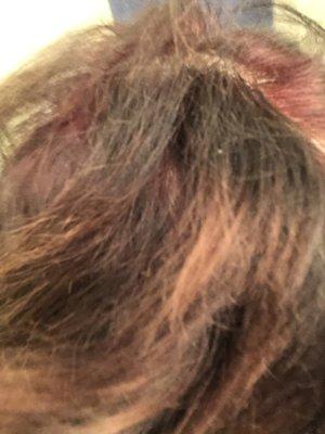 Patchy red hair dye done by melody Blake