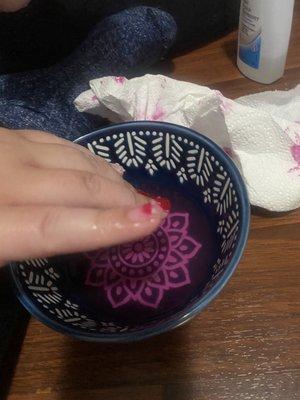 Dissolving the nails in acetone because keeping them any longer was painful