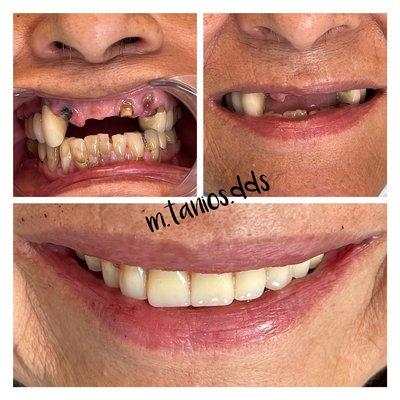 Smile makeover!