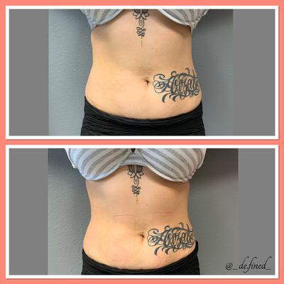 Before and after pictures of my client's 1st session, she lost two inches off her waist. Book your appointment now for visible results