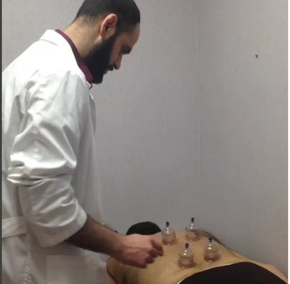 Hijama