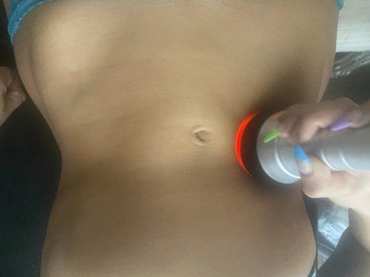 Lipo Cavitation - Fat Dissolving