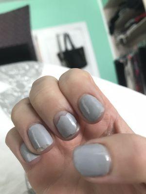 Chipped nails