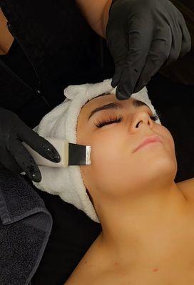 Microdermabrasion