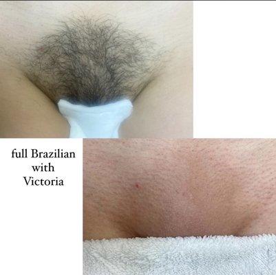 Full Brazilian sugaring with Victoria :)