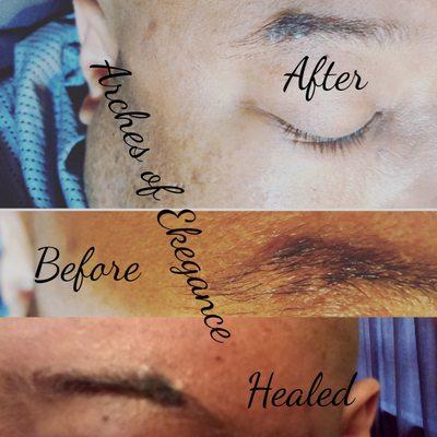 Men can get Microblading/shading...this gentlemen had a scar he wanted covered, so I applied Microshading..he's very HAPPY with the results!