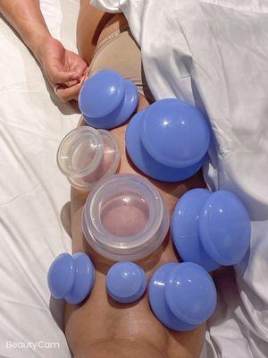 Cupping focusing on Hamstring!!!Help to alleviate pain and restore flexibity.