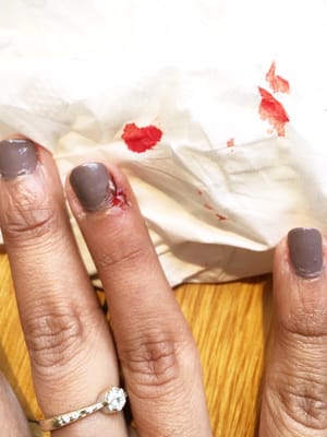 My finger continued bleeding an hour after the manicure cz the cut was so deep.