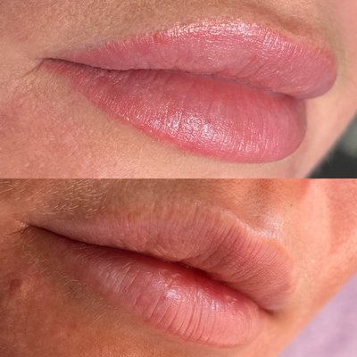 Healed lips blushing